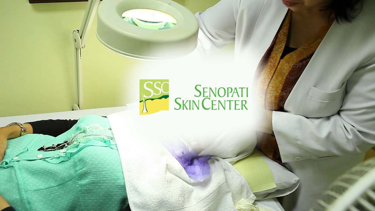 Jenis perawatan di senopati skincare center