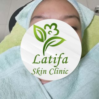 Perawatan di Latifa Skin Care