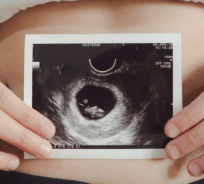 Informasi Biaya Usg Kehamilan Oktober 2021